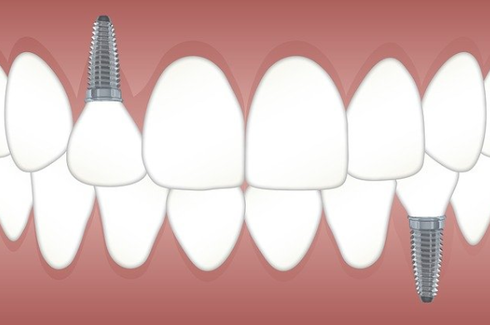 2db4af5f8b3f21f79f5e0660a0c708a5_1644418901_3196.png